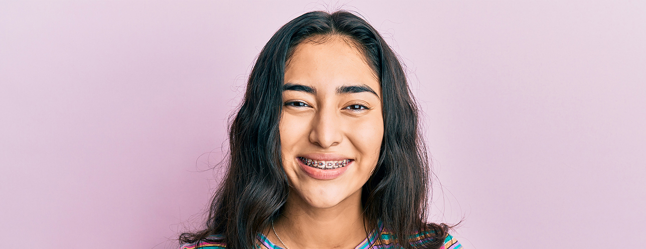 How Do Braces Move Your Teeth?