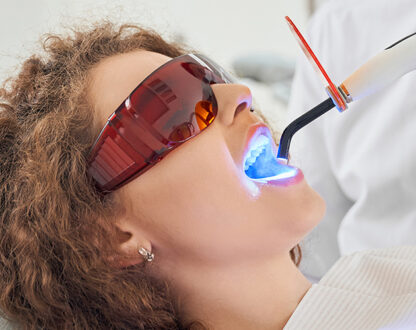 How Much Does Teeth Whitening Cost in Sugar Land Tx?