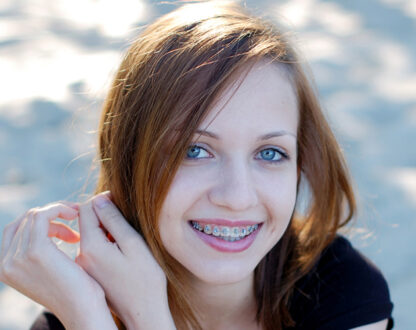 If You Are Someone Who Wears Braces, You Should Remember These Things