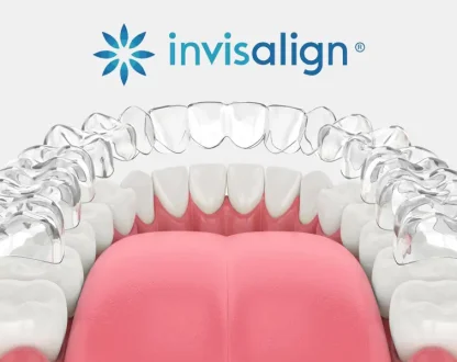 How Clear Aligners Create Space and Improve Tooth Alignment